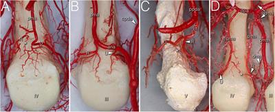 Vascular supply of the metacarpophalangeal joint